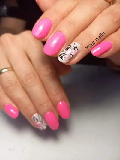 Your nails