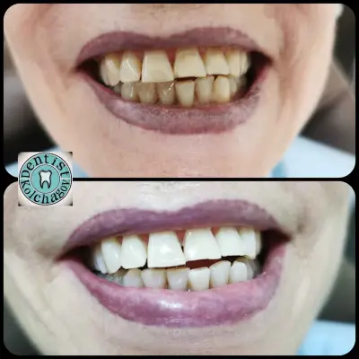 Зъболекар Колчагов Dentist Kolchagov