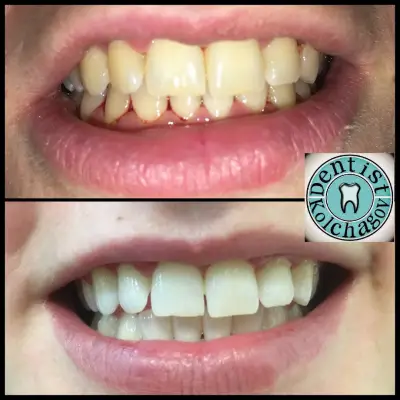 Зъболекар Колчагов Dentist Kolchagov