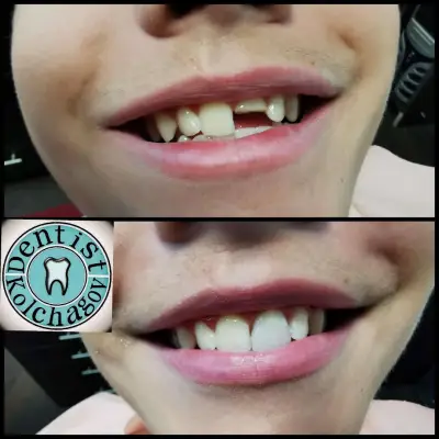Зъболекар Колчагов Dentist Kolchagov