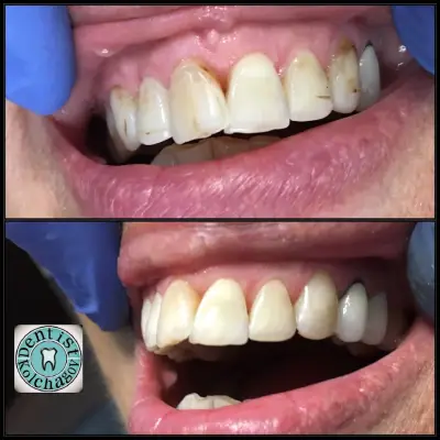 Зъболекар Колчагов Dentist Kolchagov