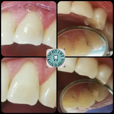 Зъболекар Колчагов Dentist Kolchagov