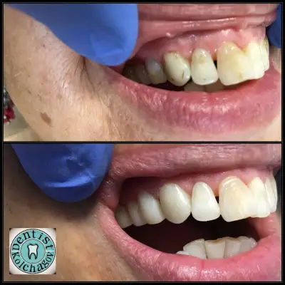 Зъболекар Колчагов Dentist Kolchagov