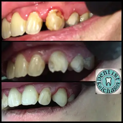 Зъболекар Колчагов Dentist Kolchagov