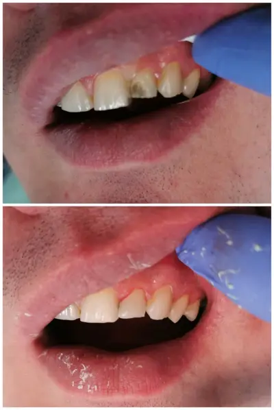 Зъболекар Колчагов Dentist Kolchagov