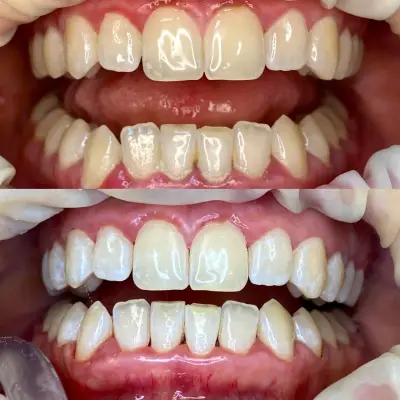 Ортодонт зъболекар София център | Twin dent