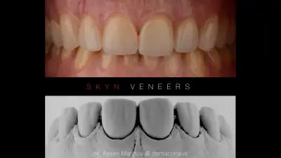 Denta Consult
