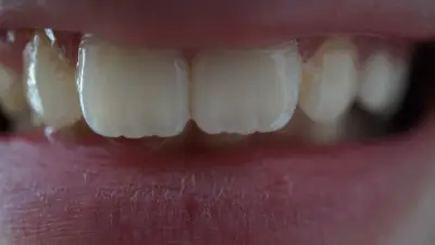 dental style 5