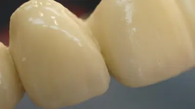 dental style 5