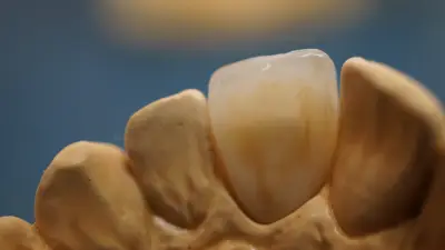 dental style 5
