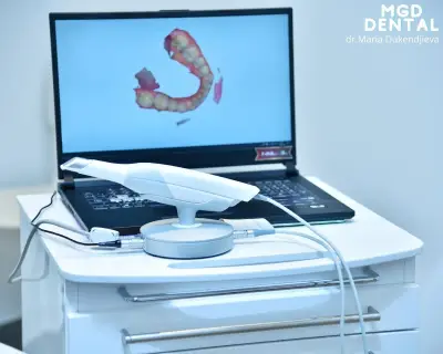 MGD dental clinic Дигитална клиника за планиране и лечение с фасети, корони и алайнери.