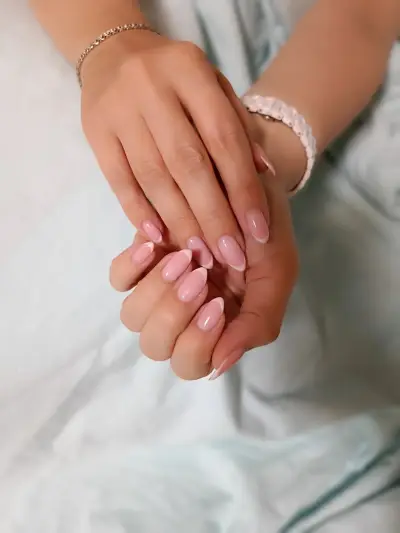 M-nails