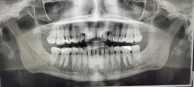 White Dent Dr. Sergeeva