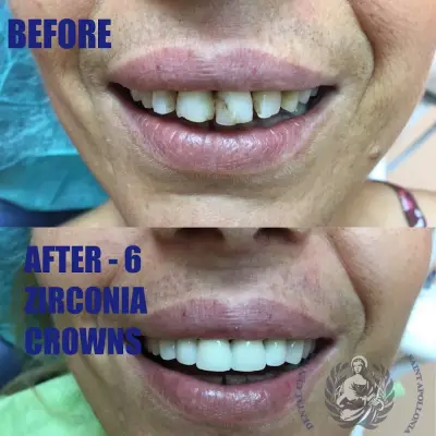 Dr. Petar Dimitrov Dentist Sunny beach/Zahnarzt Sonnenstrand/Зубной врач Солнечней берег/Зъболекар/Стоматолог Слънчев