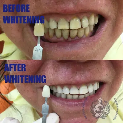 Dr. Petar Dimitrov Dentist Sunny beach/Zahnarzt Sonnenstrand/Зубной врач Солнечней берег/Зъболекар/Стоматолог Слънчев