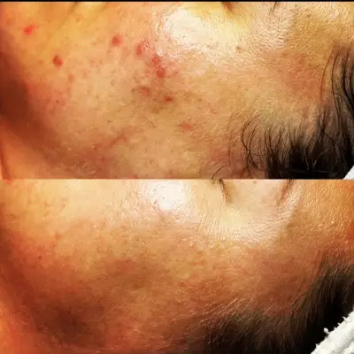 AV DINA BEAUTY STUDIO /КОЛА МАСКА- WAXING/ МАСАЖ- MASSAGES/Почистване на лице-CLEAN AND BEAUTY THERAPY FOR FACE