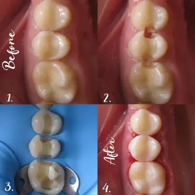 Дентална клиника ЗЪБОРАН - Zaboran dental clinic