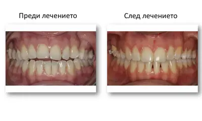 SmileArt Ортодонтска практика Варна