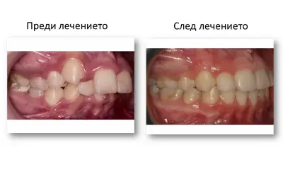 SmileArt Ортодонтска практика Варна