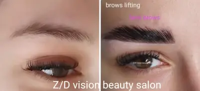 Z/D vision
