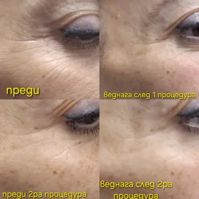 Салон за красота Ани