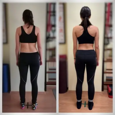 Physio Zone Burgas-Стоян Янков /рехабилитатор/