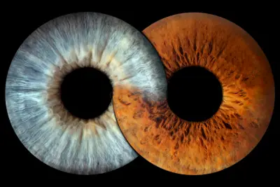 IRIS WORLD STUDIO