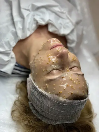 Лора козметик лазерна епилация