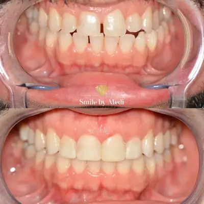 Smile By Medi
