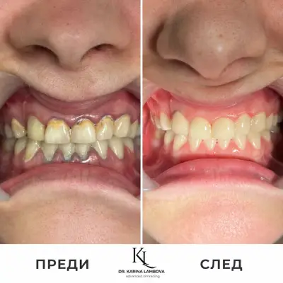 Д-р Карина Ламбова - Дентална медицина