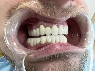 SUNSMILE | Panchevi Dental Clinic