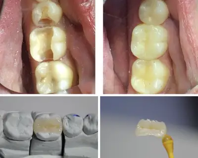 Endodont Dental Clinic Dr. Yordanov