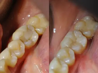 Endodont Dental Clinic Dr. Yordanov