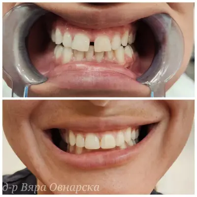 Faith Dental Care - д-р Вяра Овнарска