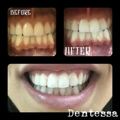 Dentessa, д-р Велина Илева
