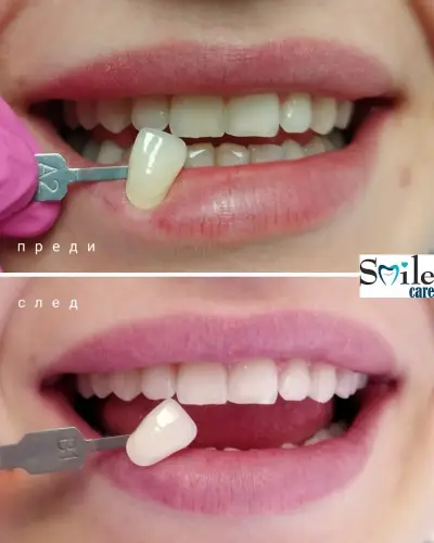 Smile Care Dr. Natalia Chervenkova