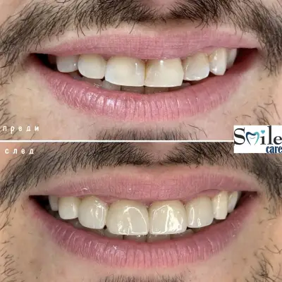 Smile Care Dr. Natalia Chervenkova
