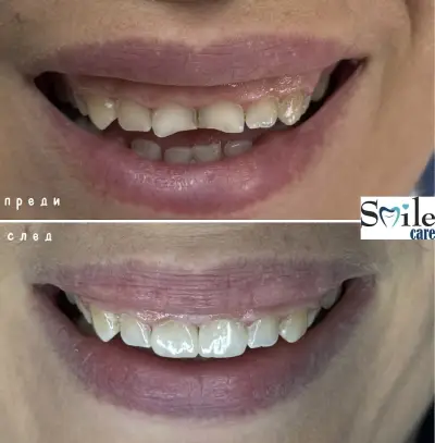 Smile Care Dr. Natalia Chervenkova