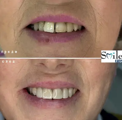Smile Care Dr. Natalia Chervenkova