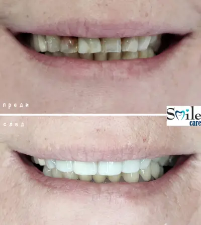 Smile Care Dr. Natalia Chervenkova