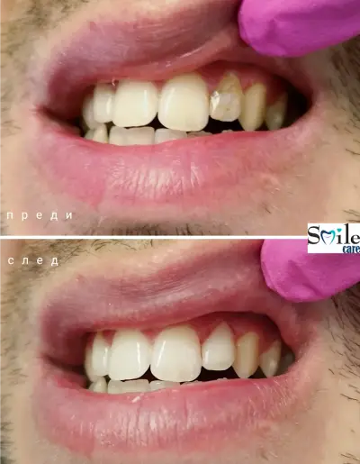 Smile Care Dr. Natalia Chervenkova