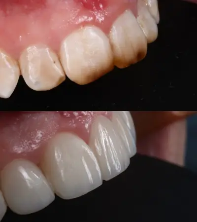 Дентална практика - DENTACARE