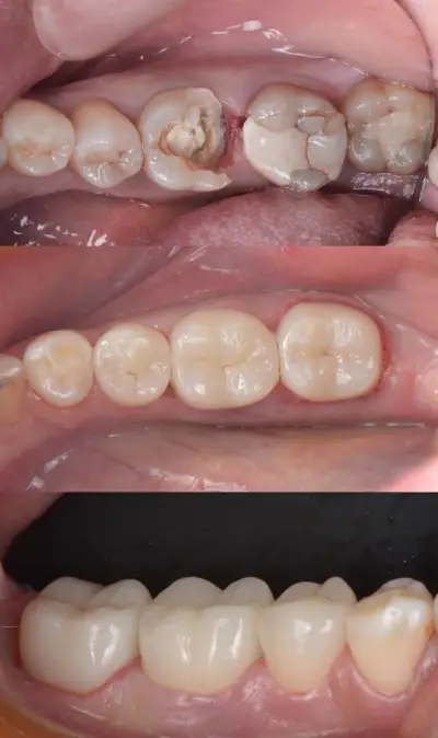 Дентална практика - DENTACARE