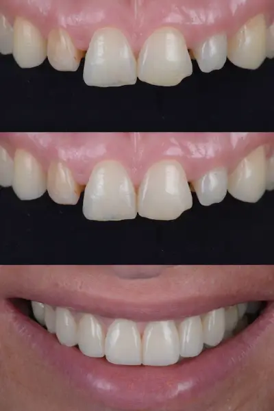 Дентална практика - DENTACARE