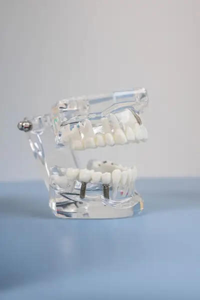 SPASOV DENTAL | Д-р Самуил Спасов