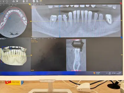 Dental X-RAY LAB Смолян