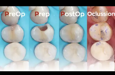EADENTA Microscopic Dentistry by Dr.Emil Sariev