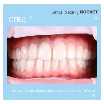 Стоматологичен кабинет Габрово “Rocket”/ Dental cabinet Gabrovo