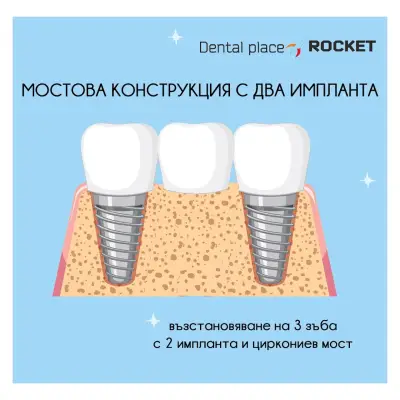 Стоматологичен кабинет Габрово “Rocket”/ Dental cabinet Gabrovo