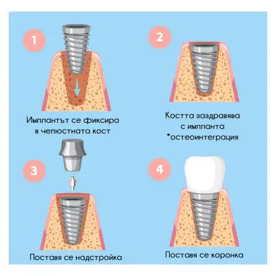 Стоматологичен кабинет Габрово “Rocket”/ Dental cabinet Gabrovo